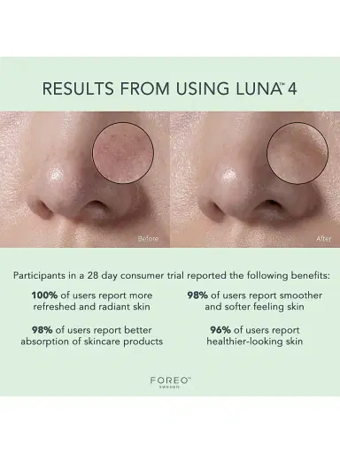 Foreo Women's Luna 4 Facial Cleansing & Firming Massage Device For Combination Skin | Thumbnail 7