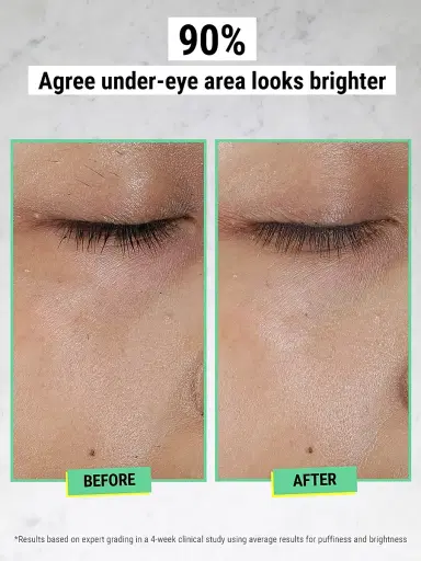 Kiehl's Since 1851 Women's Avocado Creamy Eye Treatment 0.95 oz | Thumbnail 3