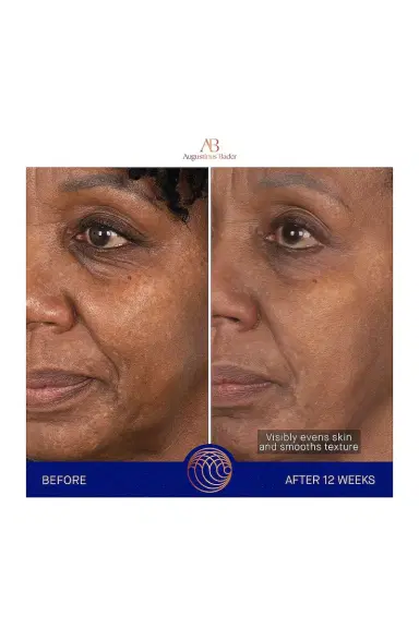 Augustinus Bader The Face Cream Mask | Thumbnail 6 Augustinus Bader The Face Cream Mask | Thumbnail 6