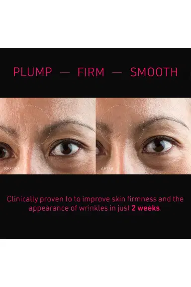 Foreo FAQ Microneedling Anti-Wrinkle Hyaluronic Acid Patches For Forehead 3 Pack | Thumbnail 6 Foreo FAQ Microneedling Anti-Wrinkle Hyaluronic Acid Patches For Forehead 3 Pack | Thumbnail 6