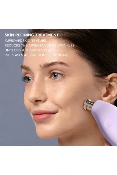Foreo KIWI Derma Microdermabrasion Device | Thumbnail 6