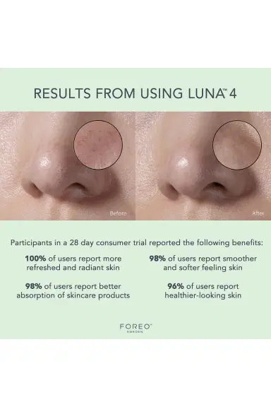 Foreo Luna 4 Facial Cleansing & Firming Device For Combination Skin | Thumbnail 6 Foreo Luna 4 Facial Cleansing & Firming Device For Combination Skin | Thumbnail 6