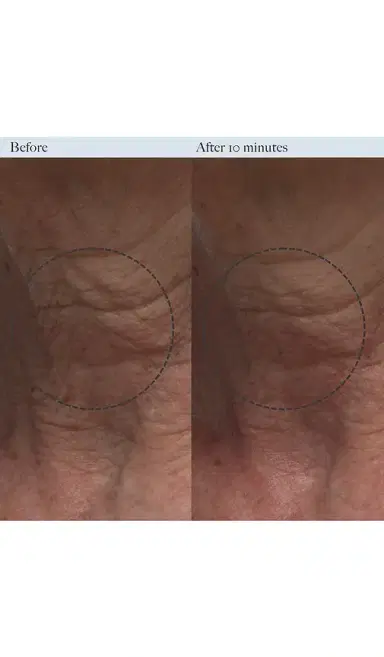 Dr. Loretta Resurfacing Enzyme Polish | Thumbnail 2 Dr. Loretta Resurfacing Enzyme Polish | Thumbnail 2