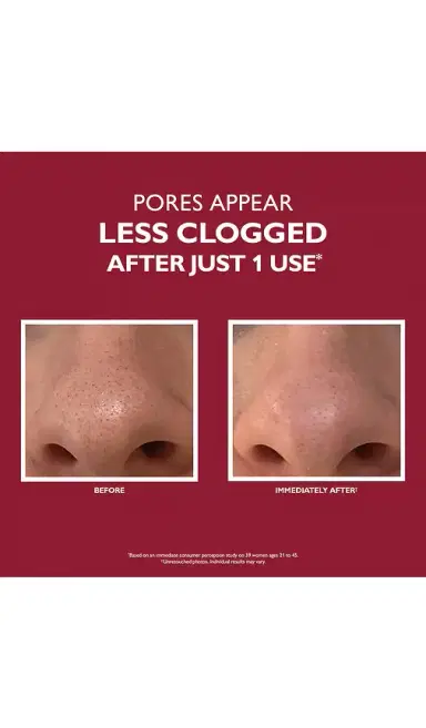 Peter Thomas Roth Even Smoother Microdermabrasion Exfoliating Pore Treatment | Thumbnail 2 Peter Thomas Roth Even Smoother Microdermabrasion Exfoliating Pore Treatment | Thumbnail 2
