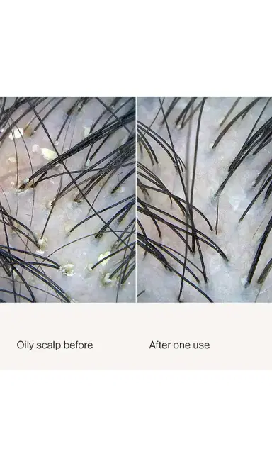 Living Proof Scalp Care Exfoliator 3.4oz. | Thumbnail 2 Living Proof Scalp Care Exfoliator 3.4oz. | Thumbnail 2
