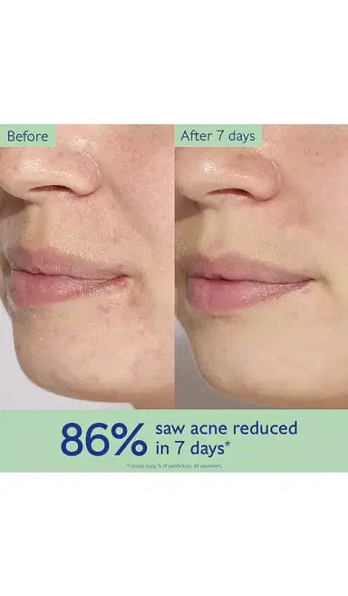 CAUDALIE Vinopure Pore Minimizing Serum | Thumbnail 2 CAUDALIE Vinopure Pore Minimizing Serum | Thumbnail 2