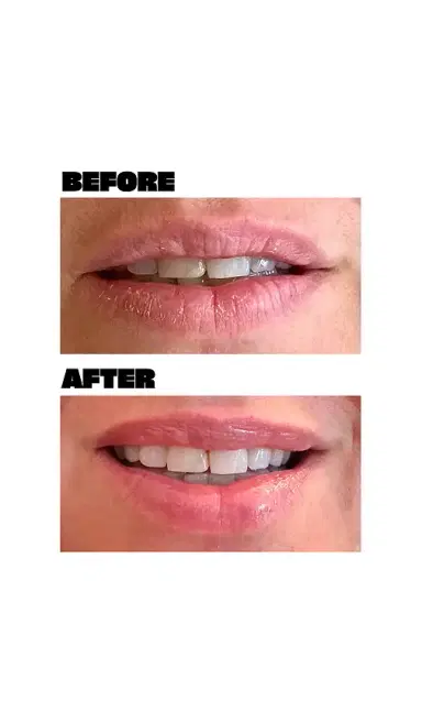 Babe Original Lip Mask | Thumbnail 2 Babe Original Lip Mask | Thumbnail 2