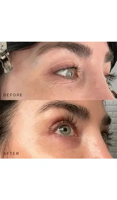 Dermaclara Occlusion Eyes & Mouth Patches | Thumbnail 2 Dermaclara Occlusion Eyes & Mouth Patches | Thumbnail 2