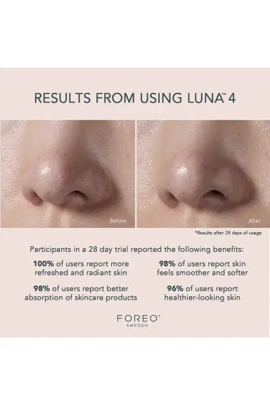 Foreo Luna 4 Facial Cleansing & Firming Device For Balanced Skin | Thumbnail 6 Foreo Luna 4 Facial Cleansing & Firming Device For Balanced Skin | Thumbnail 6