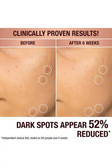 Charlotte Tilbury Dark Spot Correcting Radiance Recovery Serum 10ml | Thumbnail 4 Charlotte Tilbury Dark Spot Correcting Radiance Recovery Serum 10ml | Thumbnail 4