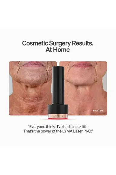 LYMA Laser Pro Starter Kit | Thumbnail 6 LYMA Laser Pro Starter Kit | Thumbnail 6