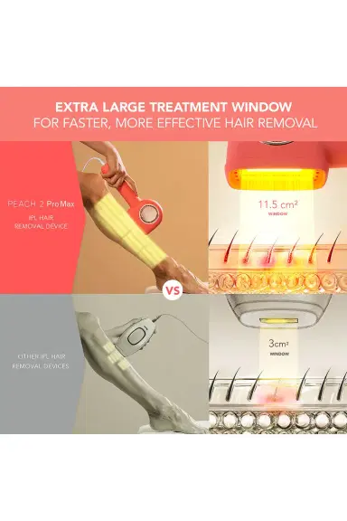 Foreo Peach 2 Pro Max IPL Hair Removal Device | Thumbnail 7