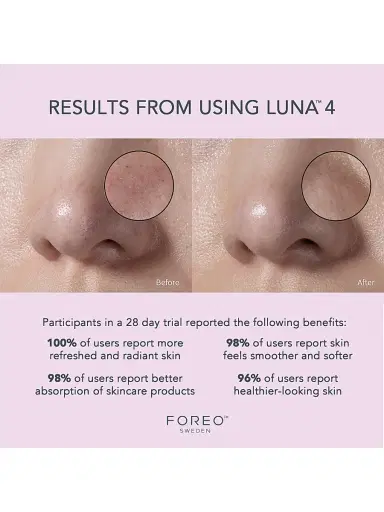 Foreo Women's Luna 4 Facial Cleansing & Firming Device For Sensitive Skin | Thumbnail 7
