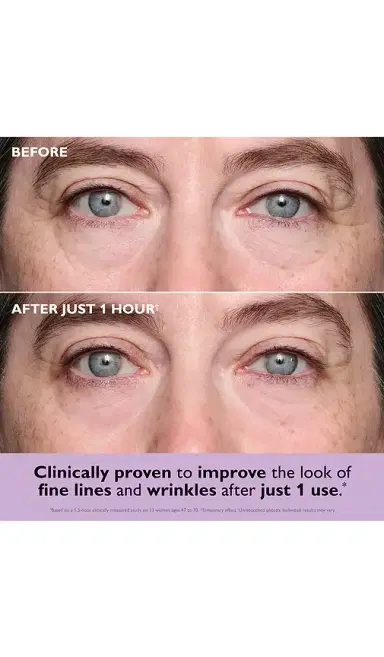Peter Thomas Roth Instant FIRMx Collagen Infusion Tightening Eye Patches 8 Pairs | Thumbnail 2 Peter Thomas Roth Instant FIRMx Collagen Infusion Tightening Eye Patches 8 Pairs | Thumbnail 2