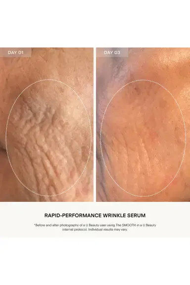 U Beauty The SMOOTH Dynamic Wrinkle Defense Serum 15ml | Thumbnail 7