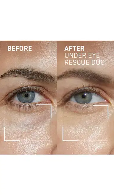 dr. brandt skincare Eye Rescue Duo | Thumbnail 2 dr. brandt skincare Eye Rescue Duo | Thumbnail 2