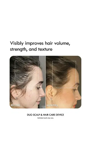 LADUORA Duo 4-in-1 Pod Based Scalp & Hair Care Device | Thumbnail 2 LADUORA Duo 4-in-1 Pod Based Scalp & Hair Care Device | Thumbnail 2