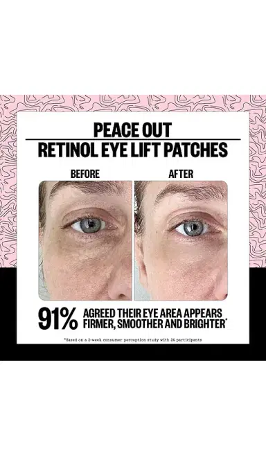 Peace Out Retinol 360° Eye Lift Patches To Lift, Firm And Revitalize Eyes | Thumbnail 2 Peace Out Retinol 360° Eye Lift Patches To Lift, Firm And Revitalize Eyes | Thumbnail 2