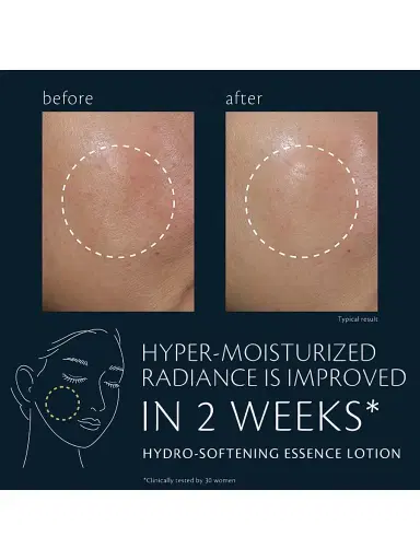 CLÉ DE PEAU BEAUTÉ Hydro-Softening Essence Lotion | Thumbnail 4