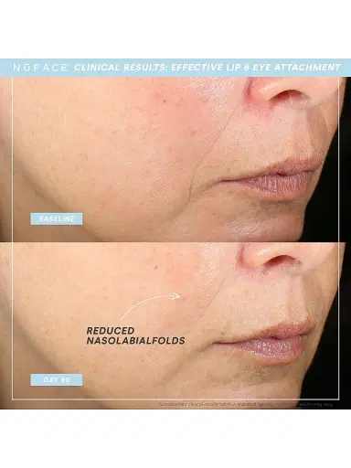 NuFace Women's TRINITY+ Effective Lip & Eye Targeted Attachment | Thumbnail 2