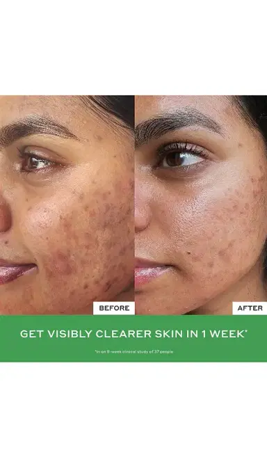 OLEHENRIKSEN Daily D-Clog Pore-Clearing Cleanser | Thumbnail 2