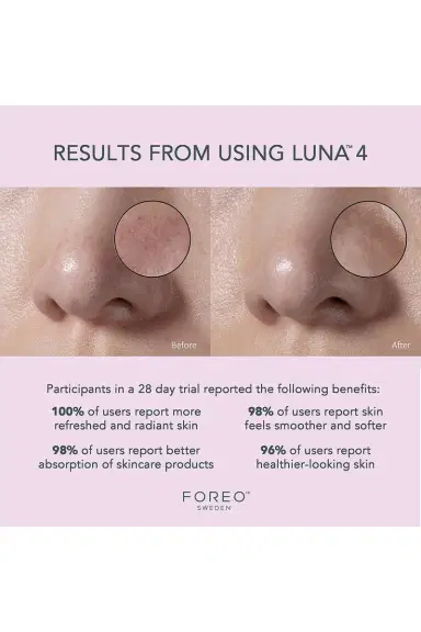 Foreo Luna 4 Facial Cleansing & Firming Device For Sensitive Skin | Thumbnail 6 Foreo Luna 4 Facial Cleansing & Firming Device For Sensitive Skin | Thumbnail 6