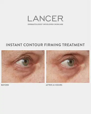 Lancer Instant Contour Firming Treatment, 1.7 oz. | Thumbnail 4 Lancer Instant Contour Firming Treatment, 1.7 oz. | Thumbnail 4