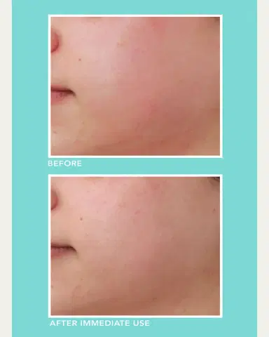 LANCER Soothe and Hydrate Serum, 1 oz. | Thumbnail 4