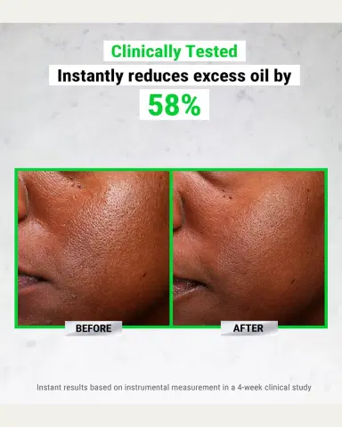 Kiehl's Since 1851 Ultra Pure High-Potency 5% Niacinamide Serum, 1 oz. | Thumbnail 2