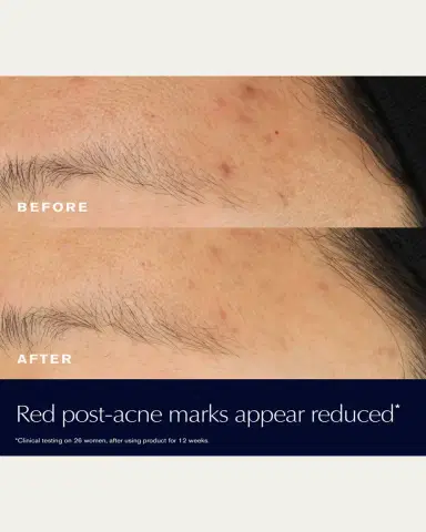 Estée Lauder Advanced Night Repair Rescue Solution Serum with 15% Bifidus Ferment, 0.68 oz. | Thumbnail 4