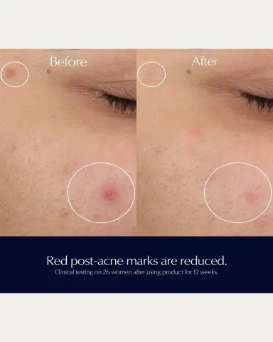 Estée Lauder Advanced Night Repair Rescue Solution Serum with 15% Bifidus Ferment, 0.68 oz. | Thumbnail 5