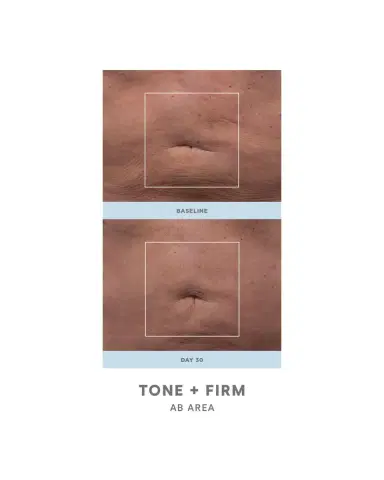 NUFACE NuBODY Skin Toning Kit | Thumbnail 3 NUFACE NuBODY Skin Toning Kit | Thumbnail 3