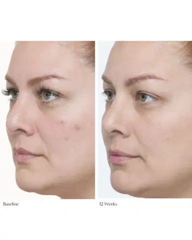 Le Prunier Plumscreen SPF 31 Broad Spectrum UVA/UVB/HEV Protection | Thumbnail 3