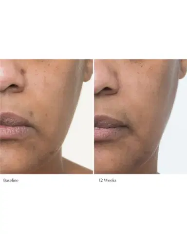 Le Prunier Plumscreen SPF 31 Broad Spectrum UVA/UVB/HEV Protection | Thumbnail 4