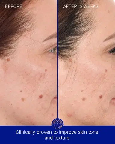 Augustinus Bader The Retinol Serum, 1.7 oz. | Thumbnail 3