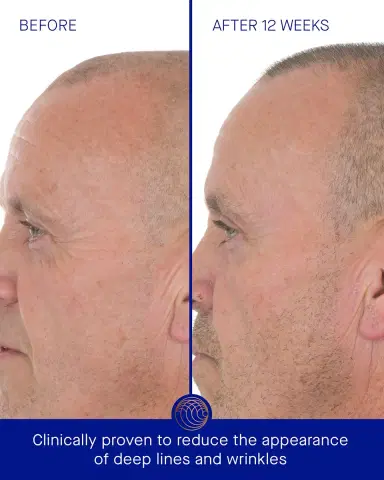 Augustinus Bader The Retinol Serum, 1.7 oz. | Thumbnail 4