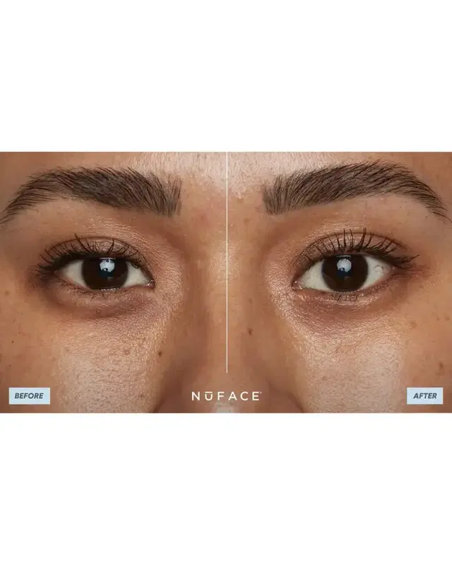 NuFace IonPlex HydraGel Eye Mask, 3.2 oz.