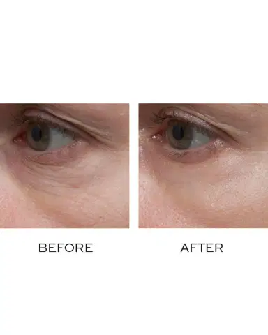 ELEMIS Ultra Smart Pro-Collagen Eye Treatment Duo | Thumbnail 4