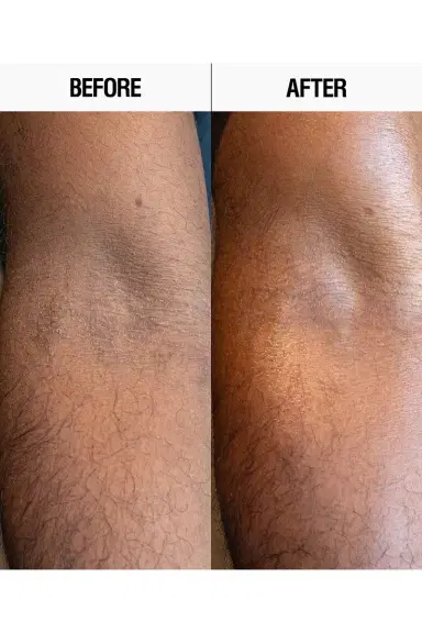 Grown Alchemist Resurfacing Targeted Body Lotion | Thumbnail 5 Grown Alchemist Resurfacing Targeted Body Lotion | Thumbnail 5