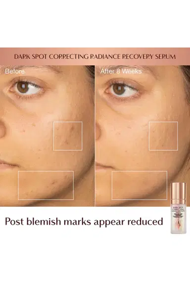 Charlotte Tilbury Dark Spot Correcting Hydration Revival Duo | Thumbnail 6 Charlotte Tilbury Dark Spot Correcting Hydration Revival Duo | Thumbnail 6