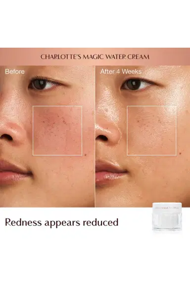 Charlotte Tilbury Dark Spot Correcting Hydration Revival Duo | Thumbnail 7 Charlotte Tilbury Dark Spot Correcting Hydration Revival Duo | Thumbnail 7