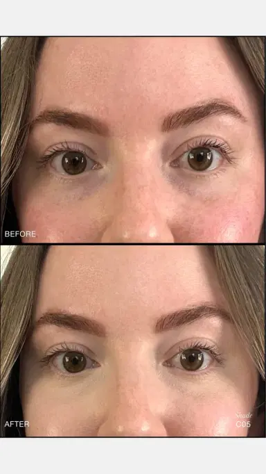 RMS Beauty Revitalize Hydra Concealer | Thumbnail 4 RMS Beauty Revitalize Hydra Concealer | Thumbnail 4