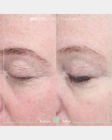 Bioeffect EGF Day Serum, 1 oz. | Thumbnail 6 Bioeffect EGF Day Serum, 1 oz. | Thumbnail 6