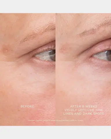 Hourglass Cosmetics 1 oz. Equilibrium Resurfacing Retinoid Treatment | Thumbnail 5