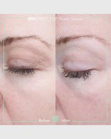 Bioeffect EGF Power Serum, 0.5 oz. | Thumbnail 7