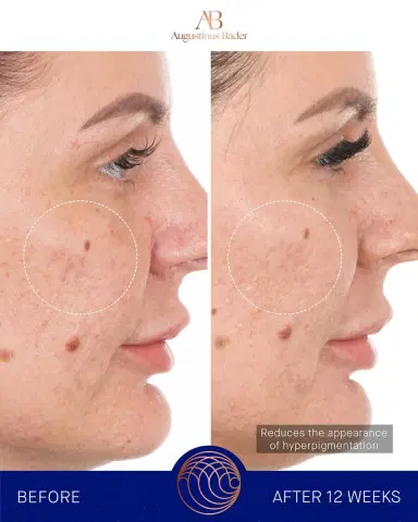 Augustinus Bader The Retinol Serum, 1 oz. | Thumbnail 3 Augustinus Bader The Retinol Serum, 1 oz. | Thumbnail 3