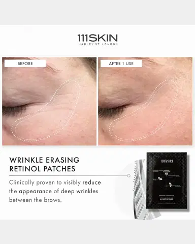 111SKIN Wrinkle Erasing Retinol Patches | Thumbnail 4 111SKIN Wrinkle Erasing Retinol Patches | Thumbnail 4