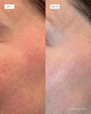 Element Eight O2 Vitamin C Serum, 1 oz. | Thumbnail 4 Element Eight O2 Vitamin C Serum, 1 oz. | Thumbnail 4