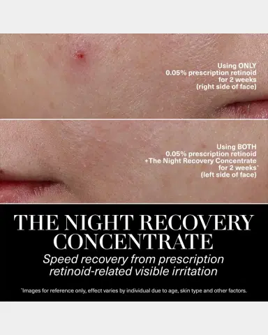La Mer The Night Recovery Concentrate | Thumbnail 4 La Mer The Night Recovery Concentrate | Thumbnail 4