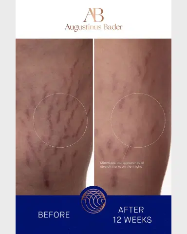 Augustinus Bader Body Cream, 6.8 oz./ 200 mL | Thumbnail 3 Augustinus Bader Body Cream, 6.8 oz./ 200 mL | Thumbnail 3